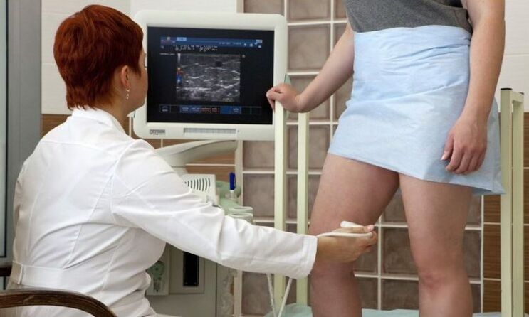 Η πήξη λέιζερ για τη θεραπεία των κιρσών φλεβών