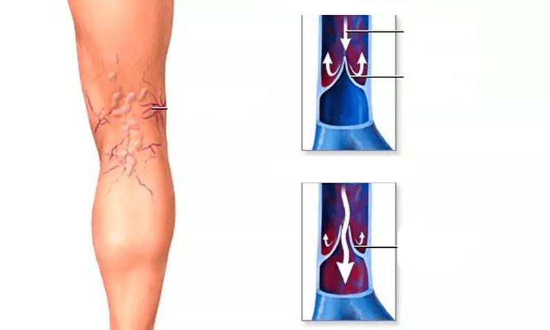 μετακίνηση αίματος