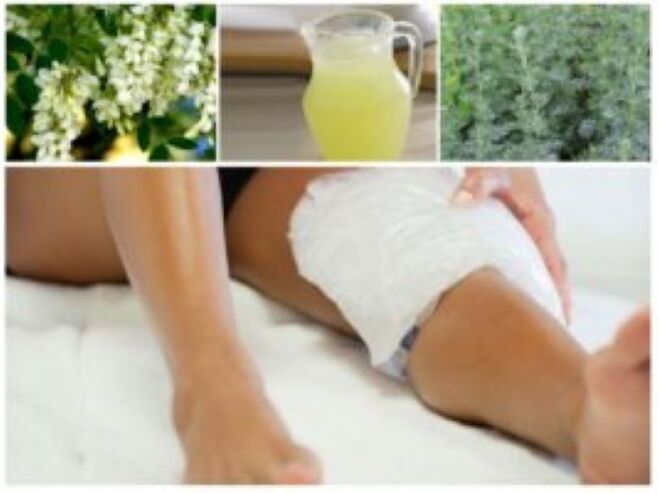 Μια πολύ αποτελεσματική λαϊκή μέθοδος για τη θεραπεία των κιρσών είναι η χρήση κομπρέσων.