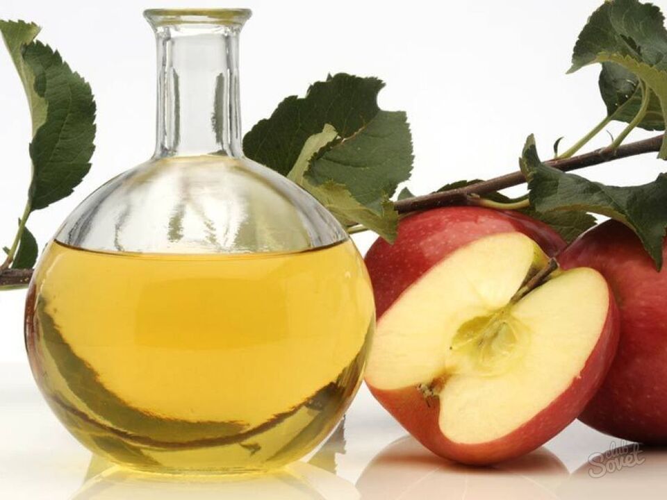 μηλόξυδο για κιρσούς